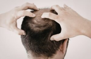 Care for the Scalp After Exercise and Swimming