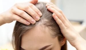 How to Exfoliate a Bald Scalp Safely Without Irritation