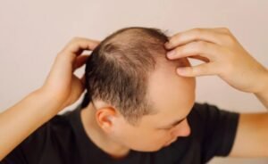 Bald Head Care Routine for Beginners Made Easy