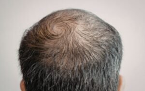 Best Moisturizers for a Bald Scalp: 7 Top Picks
