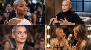 Female Celebrities With Alopecia Hollywood’s Hair Loss Stories